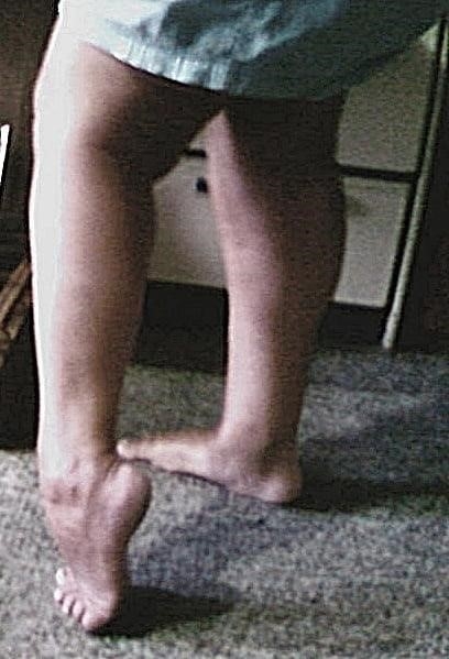 Toes feet porn-3067