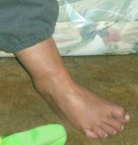 Toes feet porn-2338